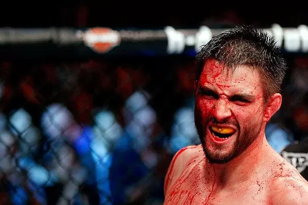 Карлос Кондит - Нил Магни. Прогноз и ставки на бой UFC (31.12.2017) Карлос Кондит - Нил Магни. Прогноз и ставки на бой UFC (31.12.2017)